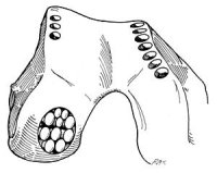 Cartilage Repair