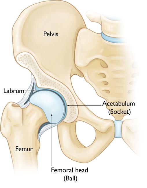 ACL Reconstruction