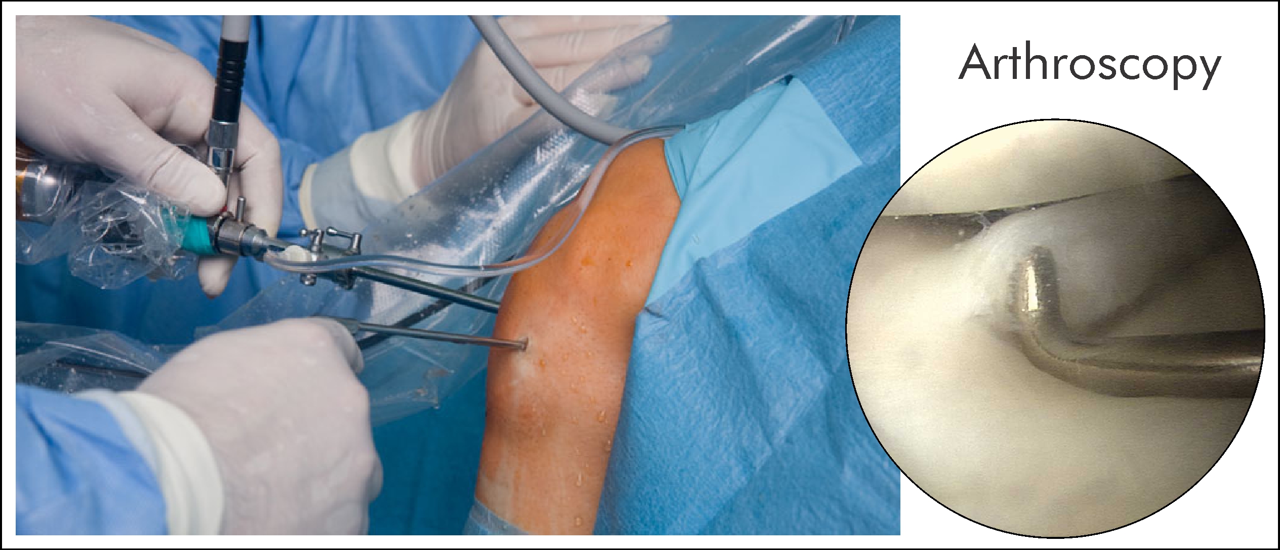 Best Arthroscopy surgeon