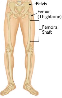 ACL Reconstruction