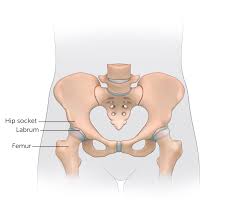 ACL Reconstruction