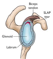 ACL Reconstruction