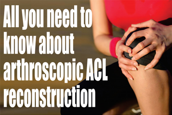 arthroscopic ACl reconstruction